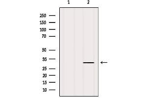 Western blot analysis of extracts from Mouse brain, using CD11c Antibody. (CD11c anticorps  (N-Term))