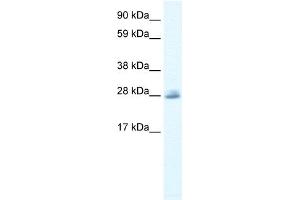 WB Suggested Anti-CLIC5 Antibody Titration:  0.