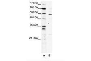 Image no. 1 for anti-PDZ and LIM Domain 5 (PDLIM5) (AA 165-214) antibody (ABIN202009) (PDLIM5 anticorps  (AA 165-214))