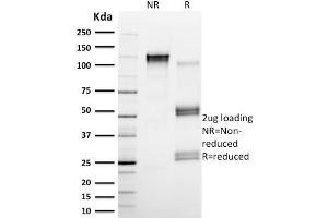 SDS-PAGE Analysis Purified Calpain 1 Mouse Monoclonal Antibody (CAPN1/1530).