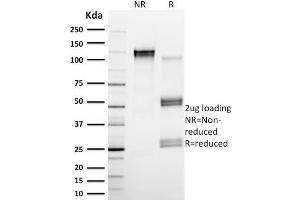 SDS-PAGE Analysis Purified Calpain 1 Mouse Monoclonal Antibody (CAPN1/1530). (CAPNL1 anticorps)