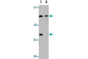 Western blot analysis of TCTN3 in HeLa cell lysate with TCTN3 polyclonal antibody  at (1) 1 and (2) 2ug/mL. (TCTN3 anticorps  (C-Term))