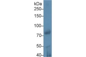 Detection of iPLA2 in Rat Testis lysate using Polyclonal Antibody to Phospholipase A2, Calcium Independent (iPLA2) (PLA2G6 anticorps  (AA 481-702))