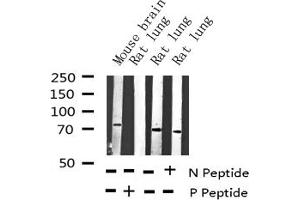 Western blot analysis of Phospho-SHP-2 (Tyr542) expression in various lysates