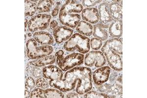 Immunohistochemical staining of human kidney with SLFN12L polyclonal antibody  shows strong cytoplasmic positivity in tubular cells at 1:20-1:50 dilution. (SLFN12L anticorps)