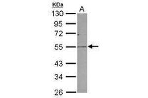 Image no. 1 for anti-Plasmalemma Vesicle Associated Protein (PLVAP) (AA 203-442) antibody (ABIN1500292)