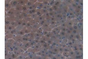 Used in DAB staining on fromalin fixed paraffin- embedded kidney tissue