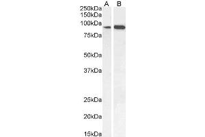 ABIN185555 (0. (IFT88 anticorps  (C-Term))