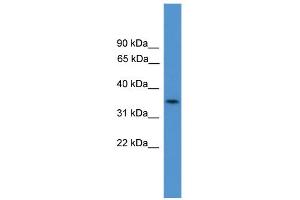 WB Suggested Anti-C4orf19  Antibody Titration: 0. (C4orf19 anticorps  (N-Term))