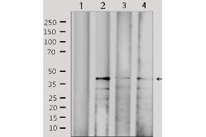 Western blot analysis of extracts from various samples, using CBX6 Antibody. (CBX6 anticorps  (N-Term))