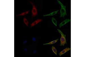 ABIN6263536 and ABIN6277080 staining 3 by IF/ICC.