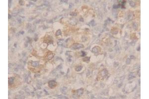 Used in DAB staining on fromalin fixed paraffin-embedded stomach tissue (MSMB anticorps  (AA 19-114))