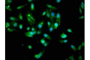 Immunofluorescence staining of Hela cells with ABIN7167024 at 1:200, counter-stained with DAPI. (AKT1 anticorps  (AA 1-480))