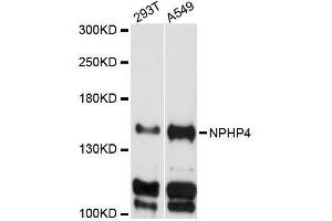 Western blot analysis of extracts of various cell lines, using NPHP4 antibody (ABIN5996805) at 1:3000 dilution. (NPHP4 anticorps)
