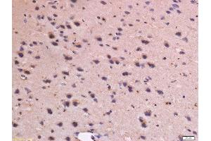 Formalin-fixed and paraffin embedded rat brain labeled with Anti-CD31 Polyclonal Antibody, Unconjugated  at 1:300 followed by conjugation to the secondary antibody and DAB staining. (CD31 anticorps  (AA 601-680))