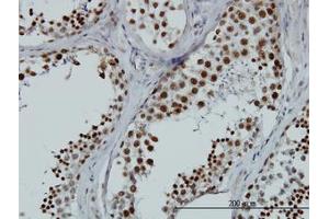 Image no. 1 for anti-RNA Binding Motif Protein, X-Linked-Like 2 (RBMXL2) (AA 1-91) antibody (ABIN599219) (RBMXL2 anticorps  (AA 1-91))