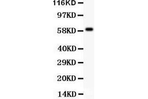 Anti- HRG antibody, Western blotting All lanes: Anti HRG  at 0. (HRG anticorps  (AA 19-200))
