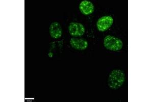 Immunofluorescence staining of Ntera-2 cells with ABIN7155816 at 1:100, counter-stained with DAPI.