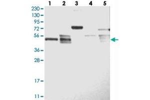 Western blot analysis of Lane 1: RT-4, Lane 2: U-251 MG, Lane 3: Human Plasma, Lane 4: Liver, Lane 5: Tonsil with LACE1 polyclonal antibody . (LACE1 anticorps)