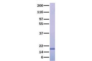 Validation with Western Blot (COL18A1 Protein (Transcript Variant 2))