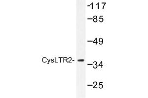 Image no. 1 for anti-Cysteinyl Leukotriene Receptor 2 (CYSLTR2) antibody (ABIN317646) (CasLTR2 anticorps)