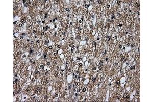 Immunohistochemical staining of paraffin-embedded liver tissue using anti-PLEKmouse monoclonal antibody. (Pleckstrin anticorps)