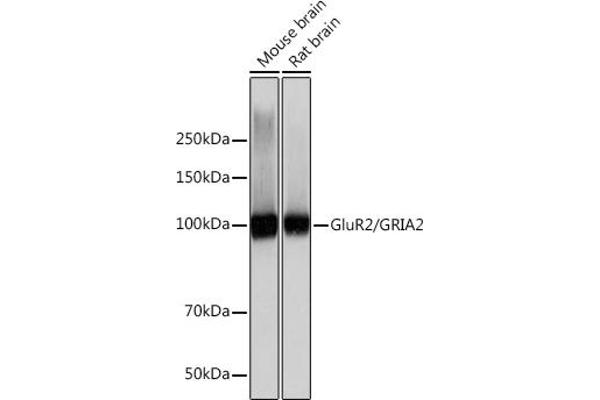 GRIA2 anticorps