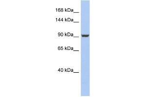 WB Suggested Anti-PMS2 Antibody Titration: 0. (PMS2 anticorps  (Middle Region))
