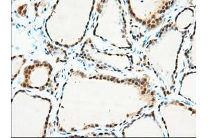 Immunohistochemistry (IHC) image for anti-3-hydroxybutyrate Dehydrogenase, Type 2 (BDH2) antibody (ABIN1496856)