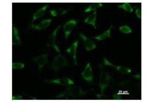 Immunostaining analysis in HeLa cells.