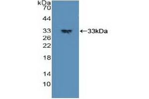 Detection of Recombinant PDPK1, Human using Polyclonal Antibody to Phosphoinositide Dependent Protein Kinase 1 (PDPK1) (PDPK1 anticorps  (AA 83-338))