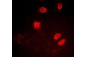 Immunofluorescent analysis of Ku80 (pT714) staining in A549 cells.