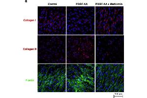 Effect on metformin on ECM production.