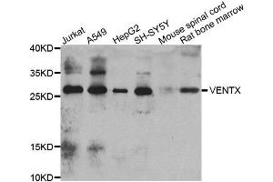 Western blot analysis of extracts of various cell lines, using VENTX antibody. (VENTX anticorps)