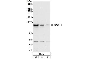 Western Blotting (WB) image for anti-Squamous Cell Carcinoma Antigen Recognized By T Cells (SART1) (AA 750-800) antibody (ABIN7452909)