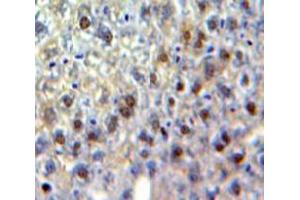 Used in DAB staining on fromalin fixed paraffin-embedded Liver tissue