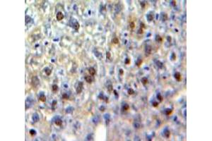 Used in DAB staining on fromalin fixed paraffin-embedded Liver tissue (CEBPG anticorps  (AA 1-150))