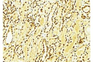 ABIN6274265 at 1/100 staining Mouse kidney tissue by IHC-P. (CK1 epsilon anticorps  (Internal Region))