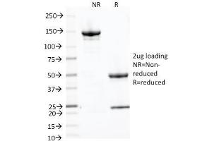 SDS-PAGE Analysis Purified CD71 Mouse Monoclonal Antibody (66IG10). (Transferrin Receptor anticorps)