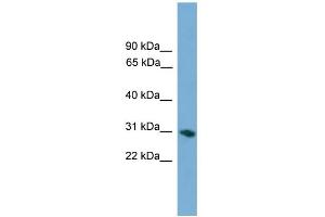 WB Suggested Anti-FCN1 Antibody Titration: 0. (FCN1 anticorps  (Middle Region))