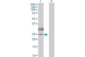 Western Blot analysis of LOC619207 expression in transfected 293T cell line by LOC619207 MaxPab polyclonal antibody. (SCART1 anticorps  (AA 1-232))