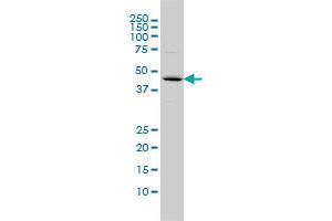 FBXO25 monoclonal antibody (M01), clone 2F1 Western Blot analysis of FBXO25 expression in COLO 320 HSR . (FBXO25 anticorps  (AA 1-367))