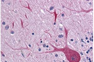 Human Brain, Cerebellum: Formalin-Fixed, Paraffin-Embedded (FFPE)