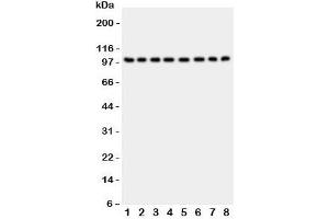 Western blot testing of CD10 antibody and Lane 1:  rat kidney;  2: (r) brain;  3: (r) liver;  4: human placenta;  5: (h) HeLa;  6: (h) Jurkat;  7: (h) Raji;  8: (h) 293T lysate;  Routinely visualized at ~100KD (MME anticorps  (AA 52-750))