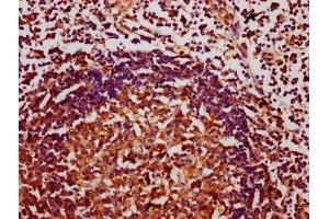 IHC image of ABIN7147681 diluted at 1:400 and staining in paraffin-embedded human lymph node tissue performed on a Leica BondTM system.