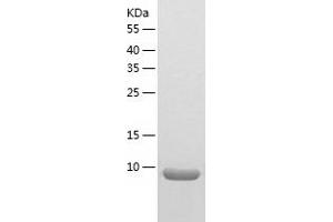 Western Blotting (WB) image for NADH Dehydrogenase (Ubiquinone) 1 alpha Subcomplex, 2, 8kDa (NDUFA2) (AA 1-99) protein (His-IF2DI Tag) (ABIN7124102)