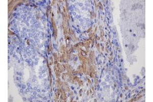 Image no. 4 for anti-Fibronectin Type III Domain Containing 4 (FNDC4) antibody (ABIN1498289)