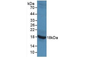 Detection of Recombinant GAD2, Rat using Monoclonal Antibody to Glutamate Decarboxylase 2 (GAD2) (GAD65 anticorps)
