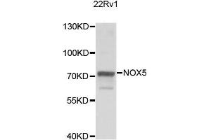 Western blot analysis of extracts of 22Rv1 cells, using NOX5 antibody. (NOX5 anticorps  (AA 661-765))