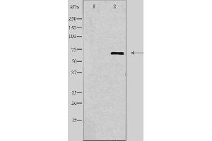Western blot analysis of extracts from HUVEC cells, using GBP1 antibody.